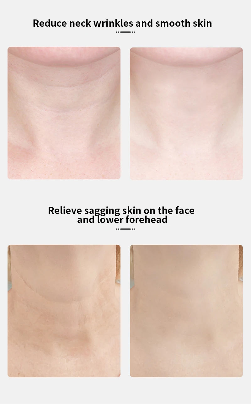 Appareil Lifting EMS - Raffermissement Visage & Cou