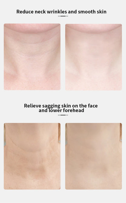 Appareil Lifting EMS - Raffermissement Visage & Cou