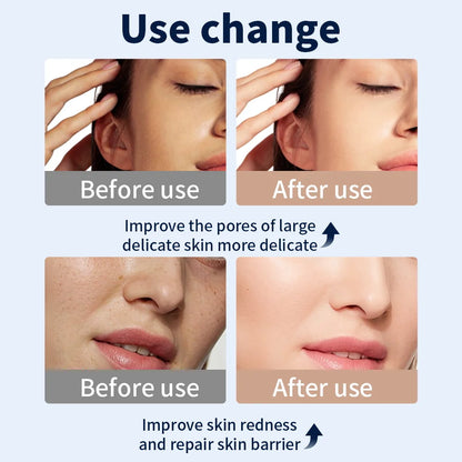 Masque LED 7 Couleurs - Thérapie Anti-Âge Professionnelle