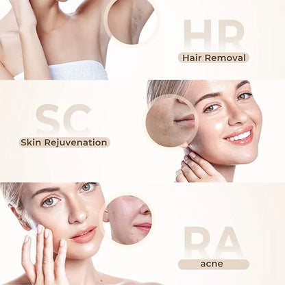 Épilateur IPL Professionnel - Épilation Définitive à Domicile