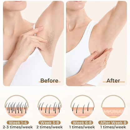 Épilateur IPL Professionnel - Épilation Définitive à Domicile